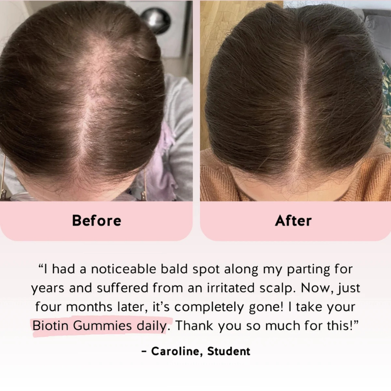 Biotin Hair Revival Bear 5000